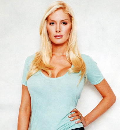 heidi montag surgery before and after. heidi montag surgery before